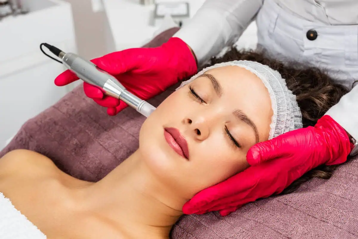 RF Microneedling by Fierce Aesthetics Med Spa - 365 Beauty in Lima, oh