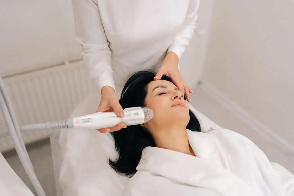 RF microneedling treatment for acne scars and skin texture