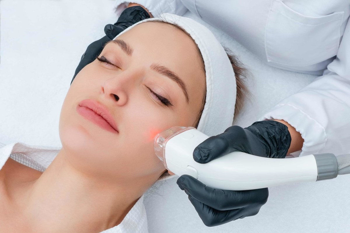 5 Essential Tips About Laser Treatments